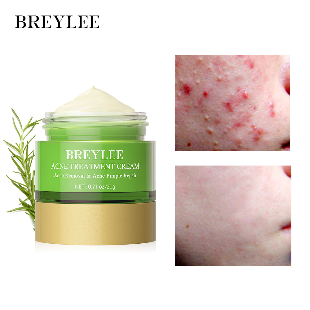 Breylee's Acne Pimple Skin Repair